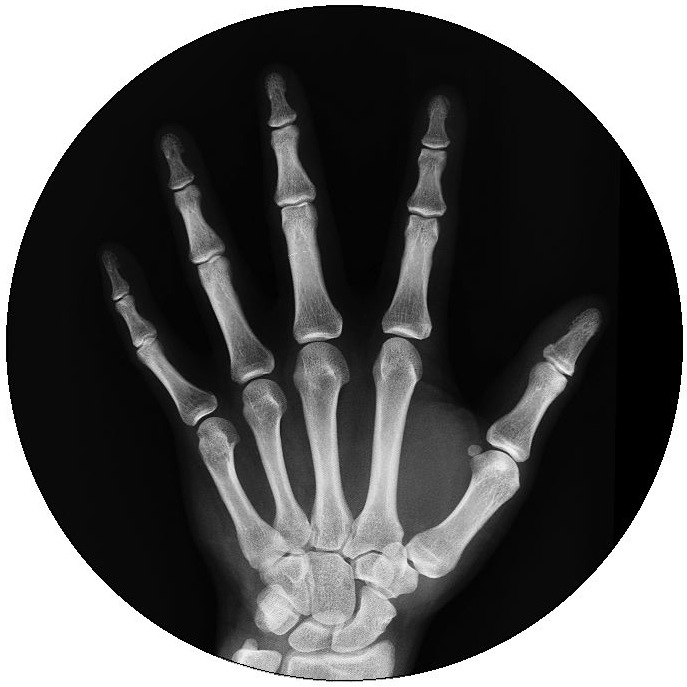 Medical X-Ray Photo Pinback Buttons and Stickers